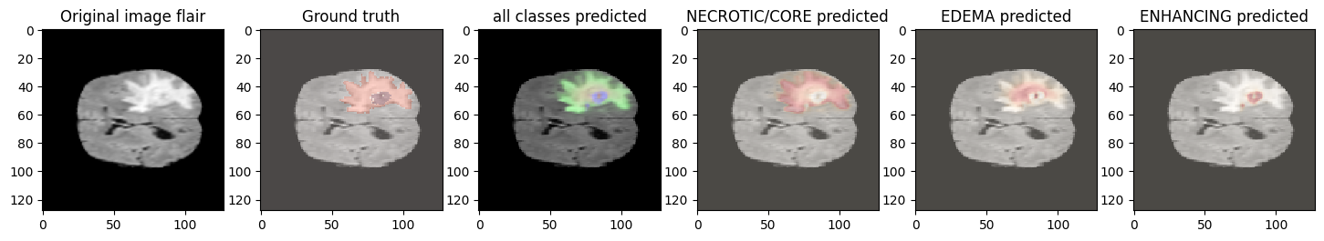 Necrotic, edema, and enhancing subregions