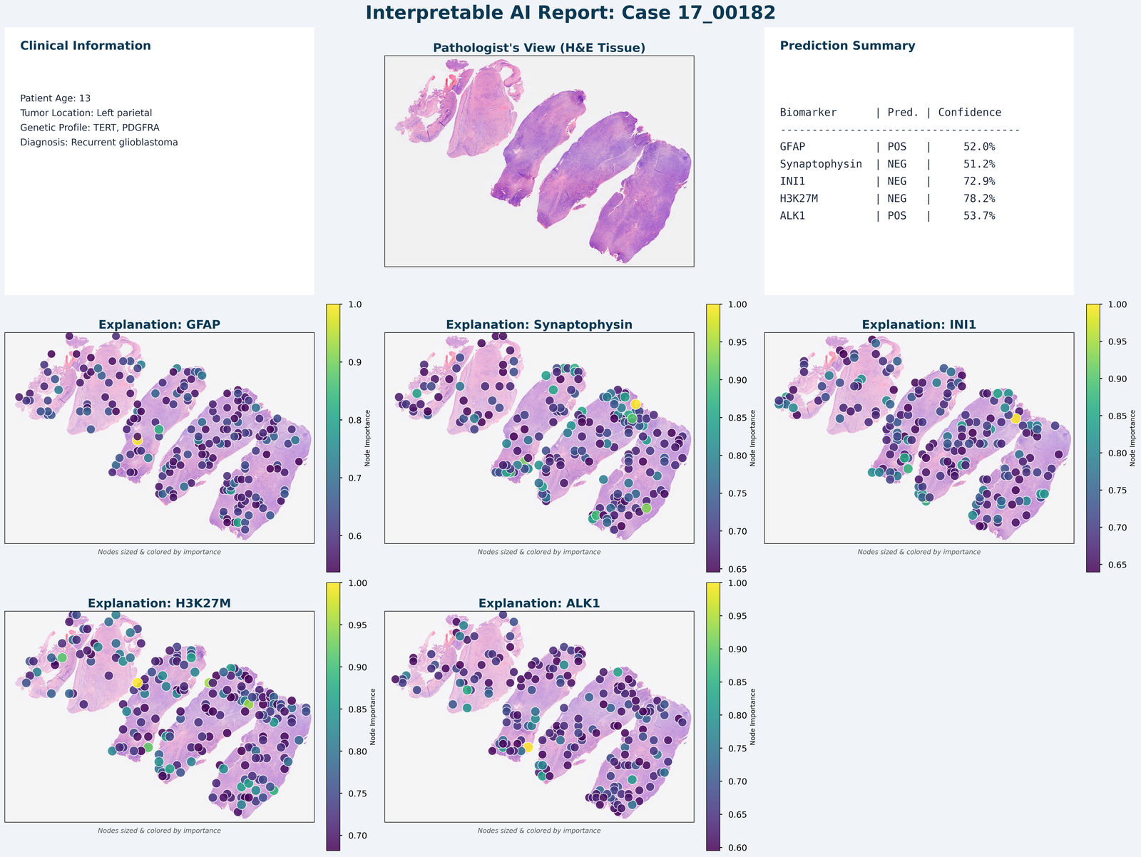 Interpretable AI clinical report